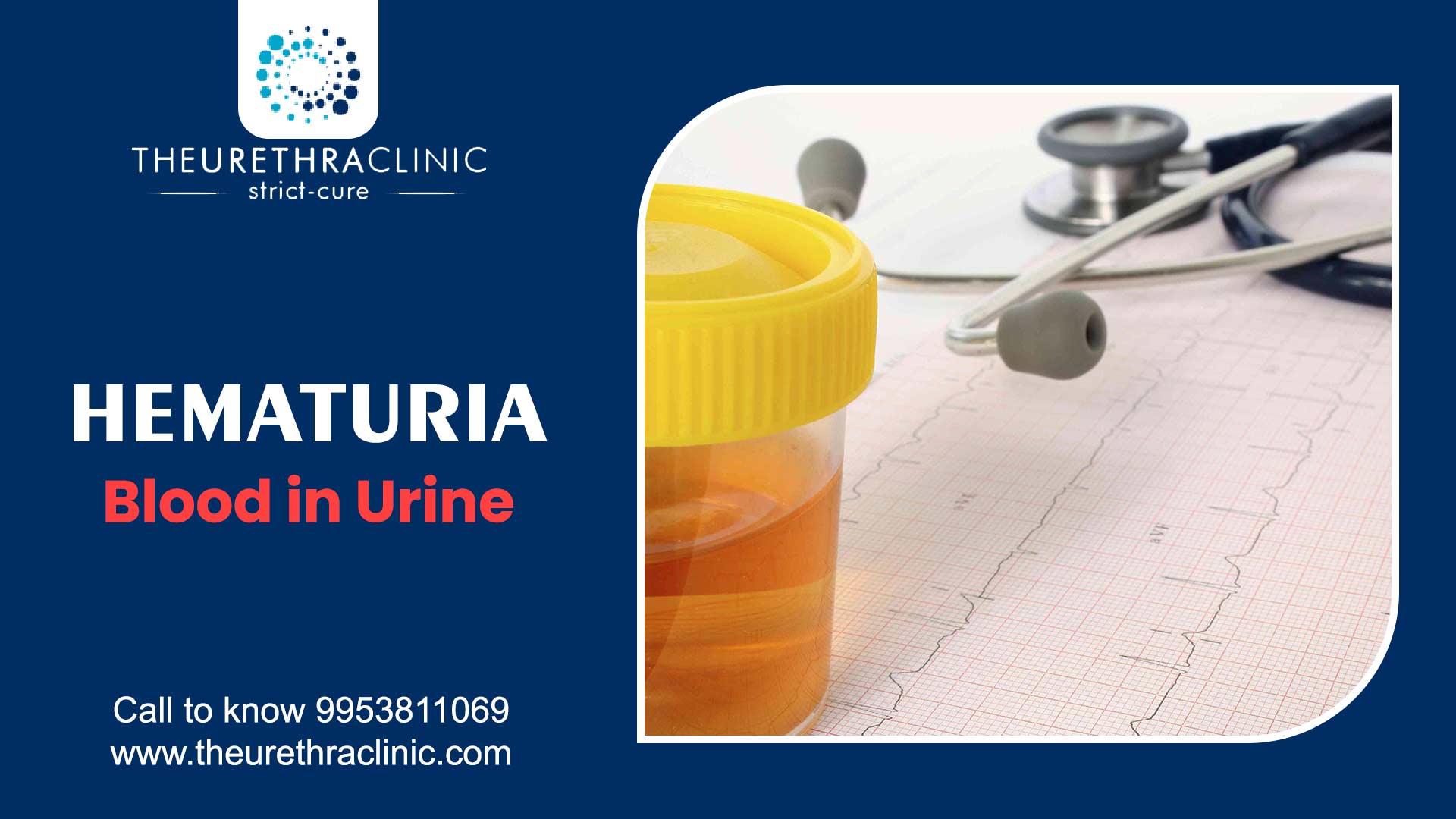 Hematuria Blood in Urine Causes, Symptoms & More