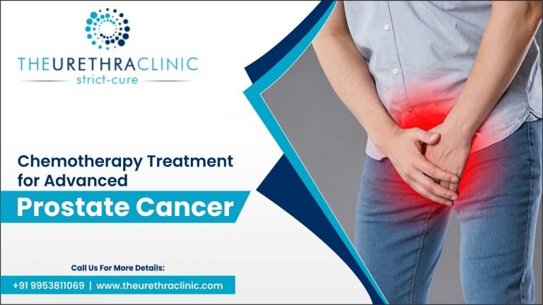Chemotherapy Treatment For Advanced Prostate Cancer The Urethra Clinic