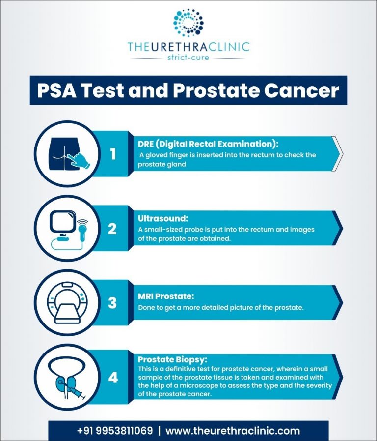 PSA testing and prostate cancer: Advised for men aged 50 and above ...