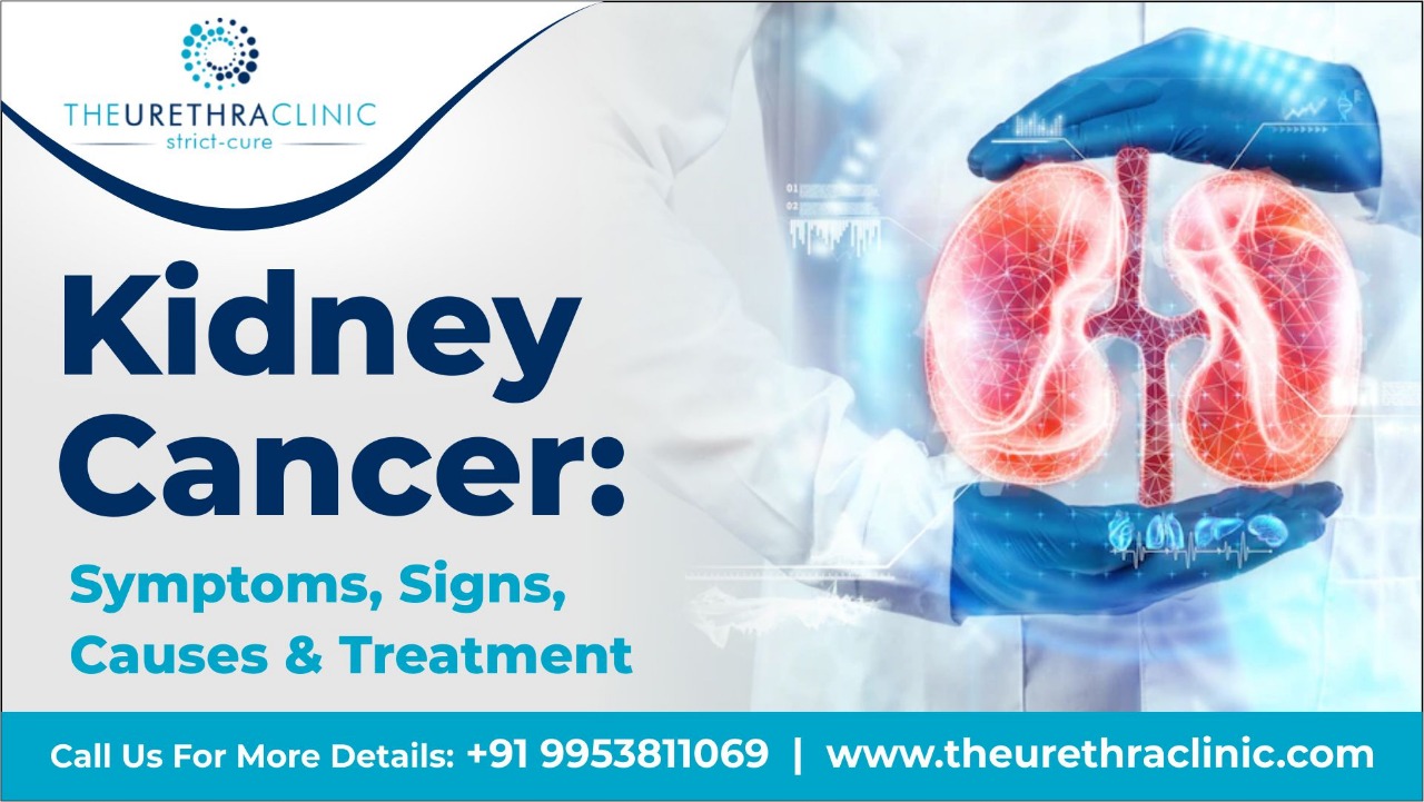 Kidney Cancer Symptoms Signs Causes And Treatment The Urethra Clinic