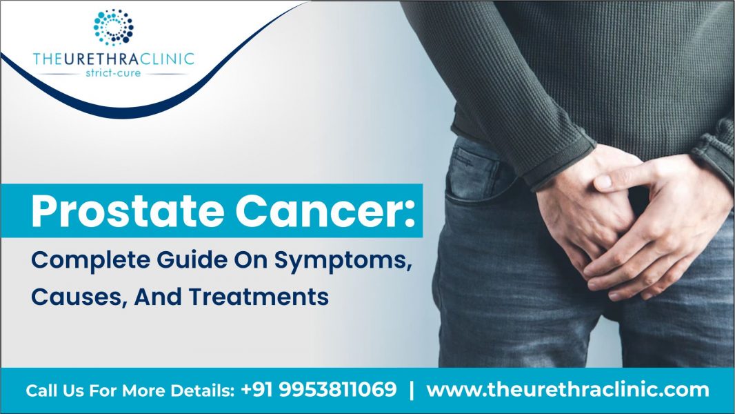 Prostate Cancer: Complete Guide On Symptoms, Causes, And Treatments